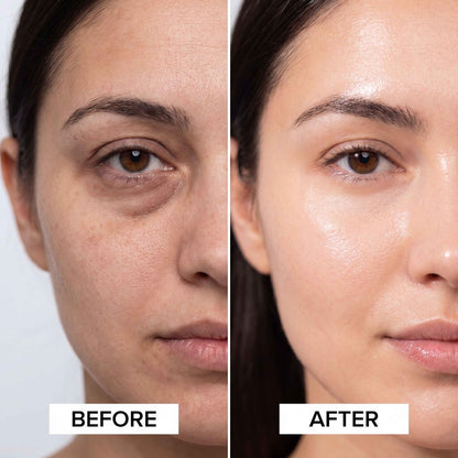 BrightLift™ | Collageen Hydrogel Oogpatches - Vaanza